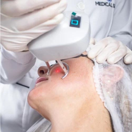 b_pisom-bb-laser-dual-wave-de-1550nm-e-1927nm-p-tratamentos-de-pele-medical-san-7