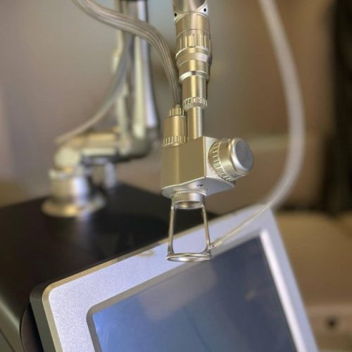 hegon-laser-c02-fracionado-medical-san-laser-dermatologico-estetica-intima-dermtologia-ibramed-14_640x640+fill_ffffff